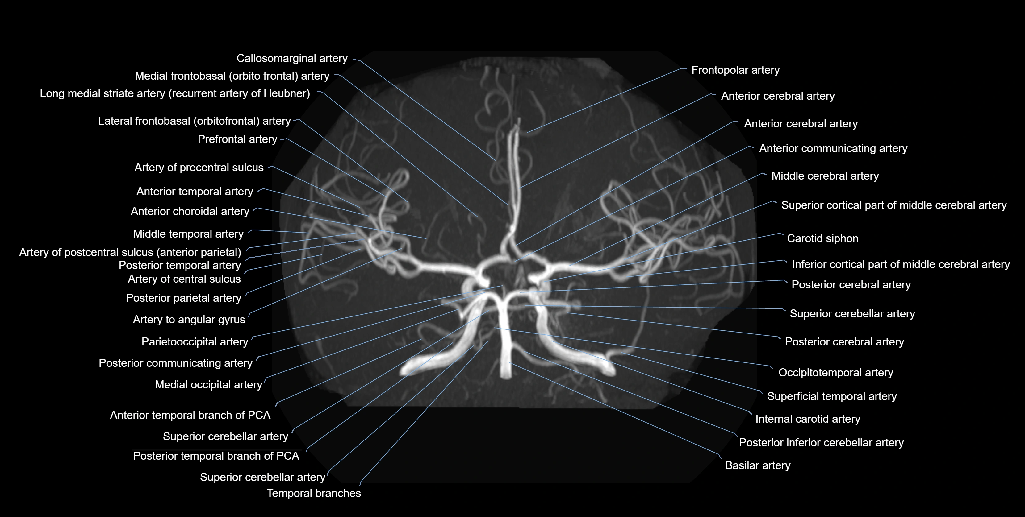 MRA brain axial MIP labelled  anatomy 3T MRI images -img-01021-00006.webp